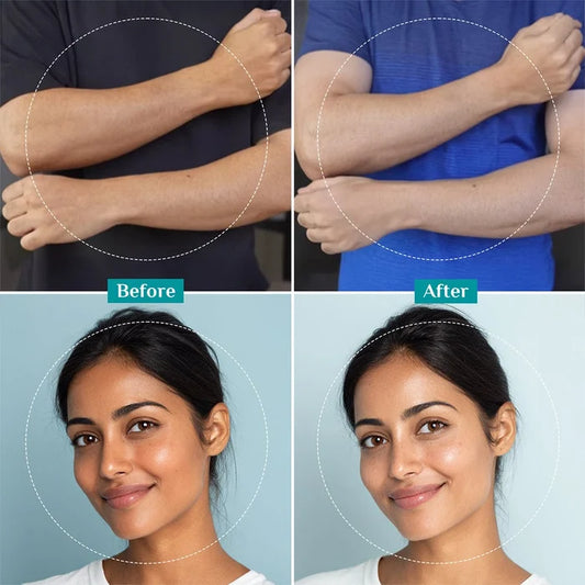 PHA Peeling Solution BUY 1 GET 1 FREE
